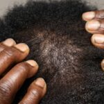 Hair Strengthening Serum: 7 Proven Tips to Avoid Costly Mistakes