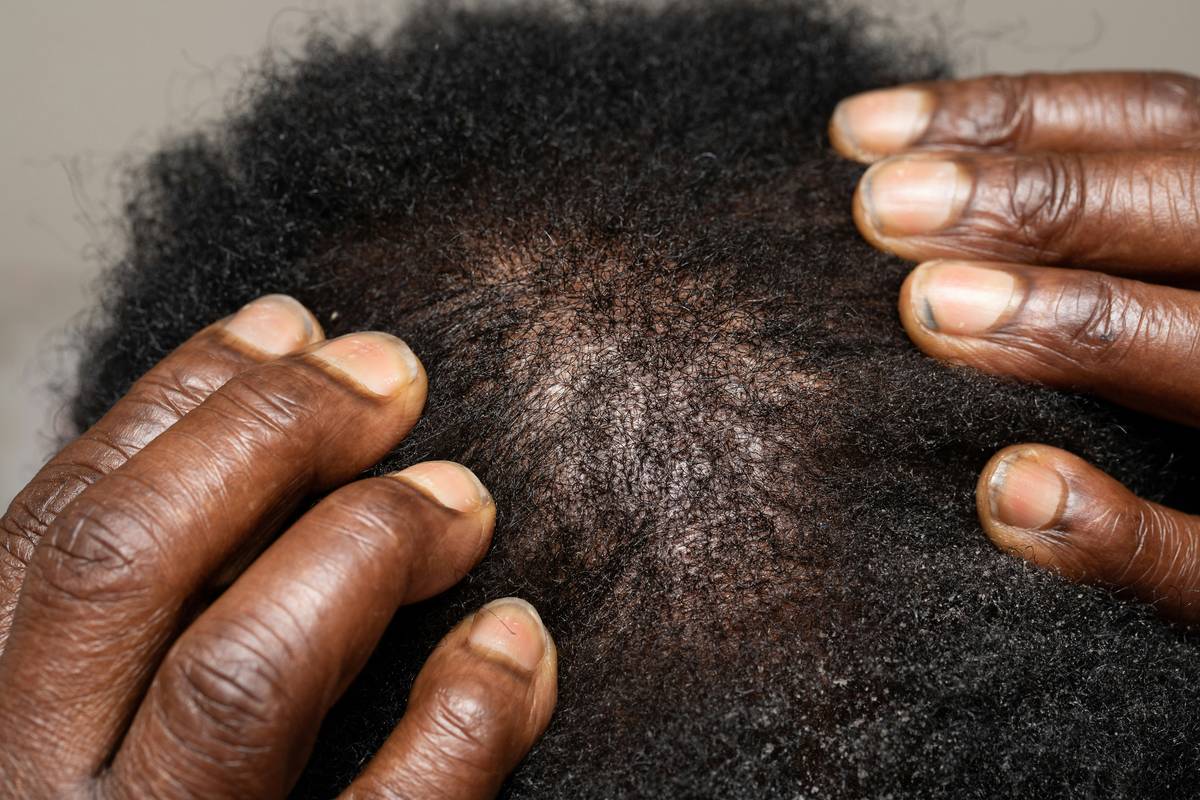 Hair Strengthening Serum: 7 Proven Tips to Avoid Costly Mistakes